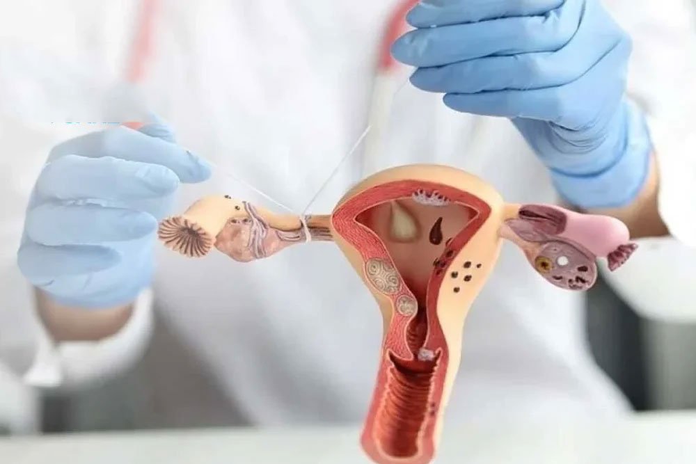 Blocked Tubes Treatment in 