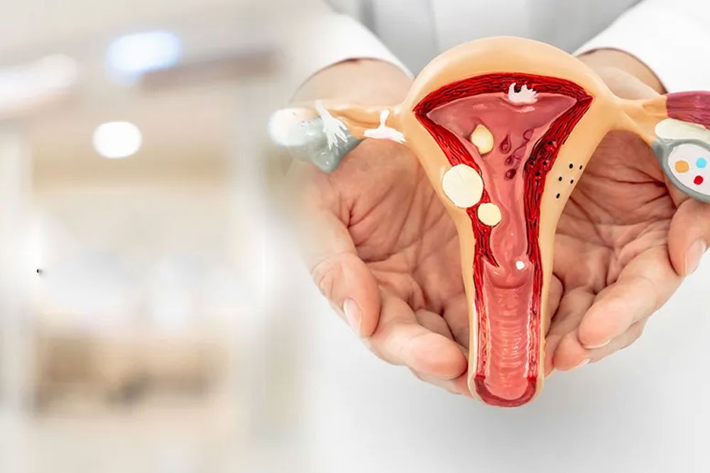 Infertility Treatment in 