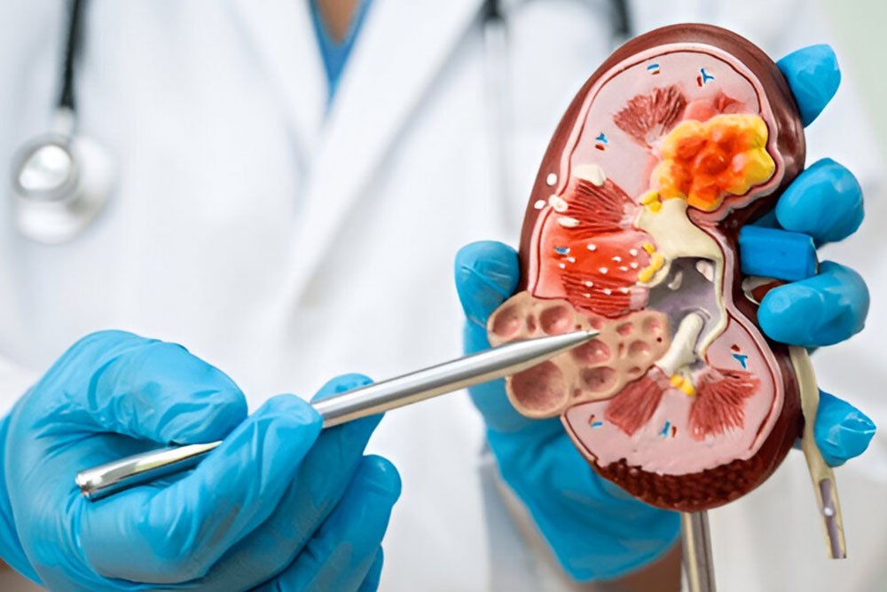 Nephrology Treatment