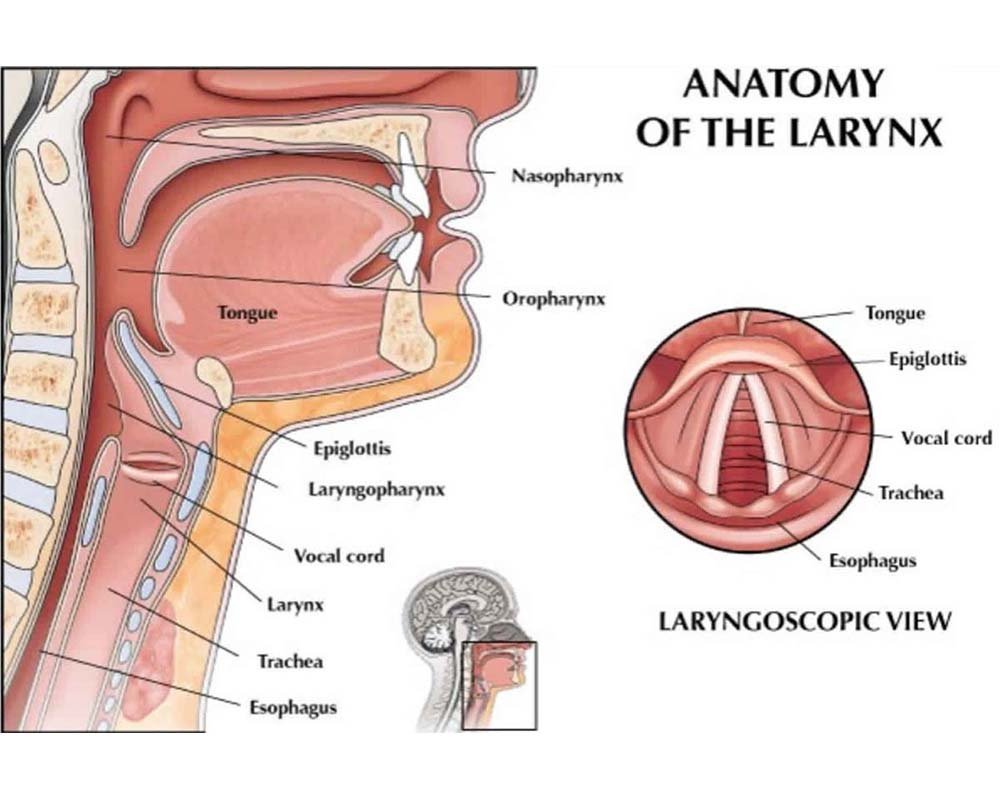 Thyroplasty Surgery in 